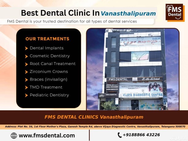 your-trusted-destination-for-quality-dental-care-in-vanasthalipuram-big-0